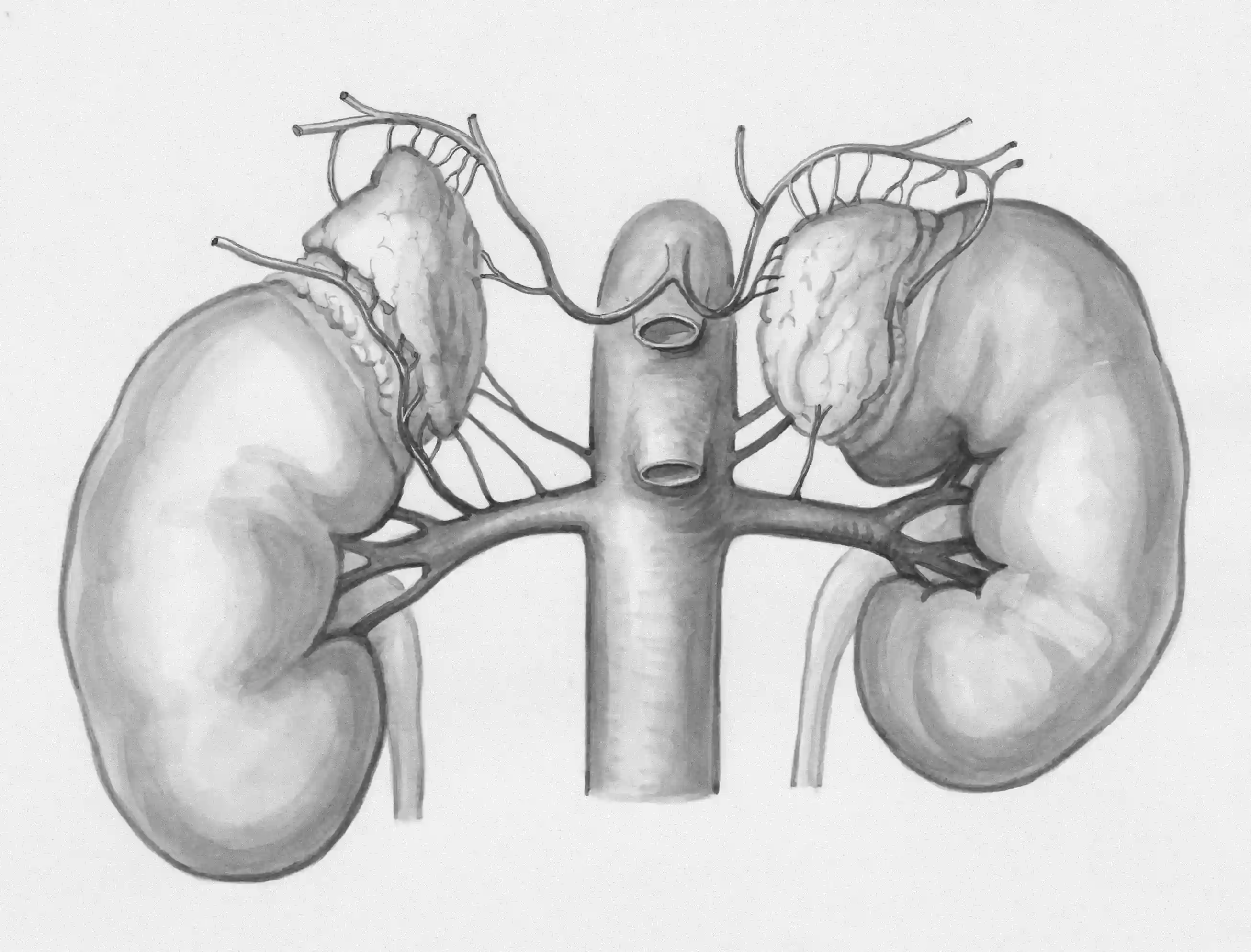 Kidney Disease â€” The Silent Condition Affecting Black Patients at Three Times the Rate